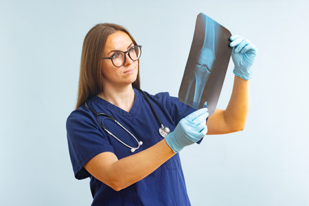 Female doctor examining xray image diagnosing injury on blue backgroundの写真素材