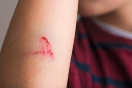 Close-Up of a Childs Arm with a Scratch.の写真素材