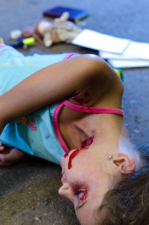 Child victim of a car accident