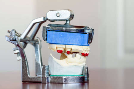 Photo of a dental mold with shallow depth of fieldの写真素材