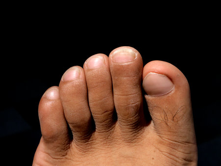 Closeup of a human foot and toes