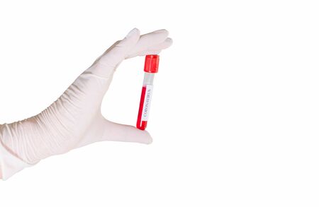 The doctor wears the glove tubelab to detect Coronavirus white background