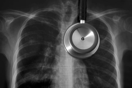 stethoscope on film x-ray