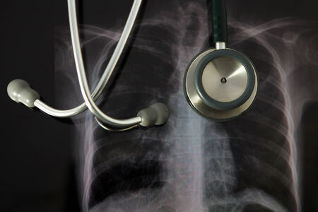 X-ray and stethoscopeの写真素材