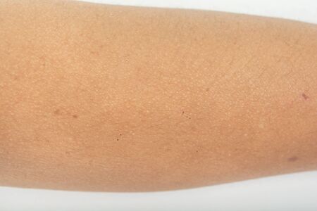 Rash and allergic reactions, skin problems, dark spots