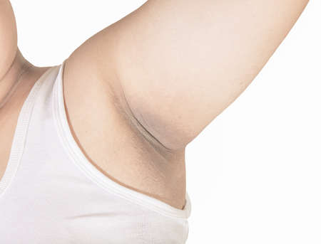 Black armpit in fat womenの写真素材