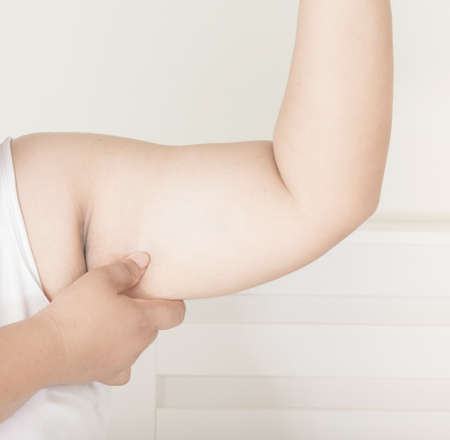 Fat arm Subcutaneous fatの写真素材