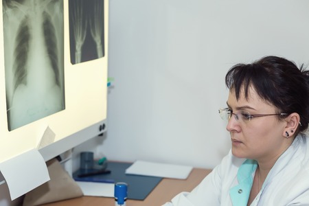 Female doctor examining an x-ray