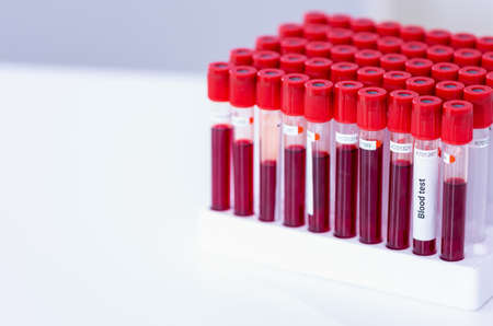 Covid-19 infected blood sample in tube on a table in research lab