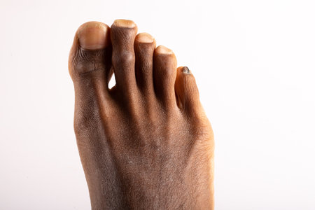 Caucasian feet with pointy, dirty and ugly toenails and wrinkled skin on a white background isolatedの写真素材