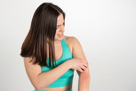 Woman scratching an itch on white background. Sensitive skin, food allergy symptoms, irritation. High-quality photoの写真素材