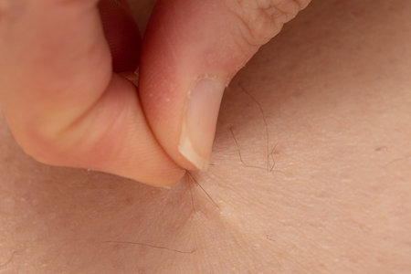 cutaneous hair receptors: concept of cutaneous hypersensitivityの写真素材