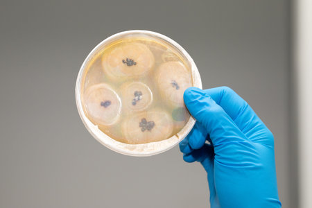 Closed Petri dish with bacterial colonies or moulds. Round glass lab equipment held in hand wearing...
