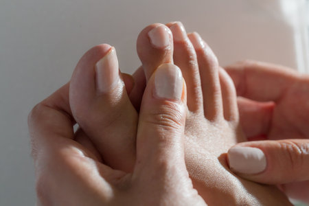 Case of palmoplantar hyperhidrosis, symptomatic sweating of hands and feet on a womanの写真素材
