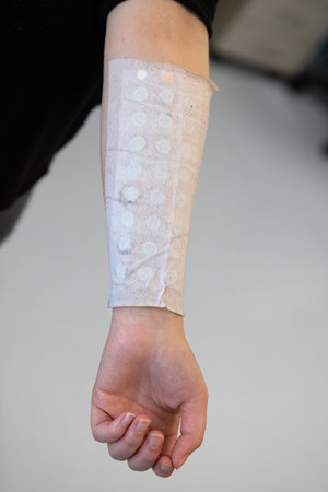 Bandage on forearm