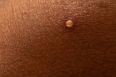 Skin pustules closeup
