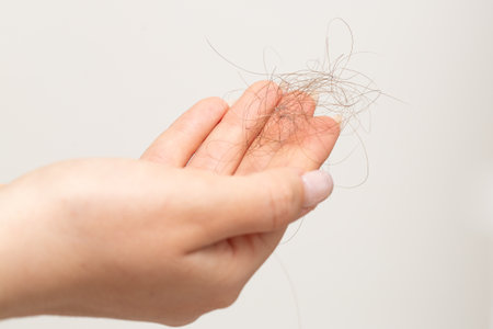 Macro of one hand of woman with fallen hair, isolated on white background. Massive hair loss problem concept.の写真素材