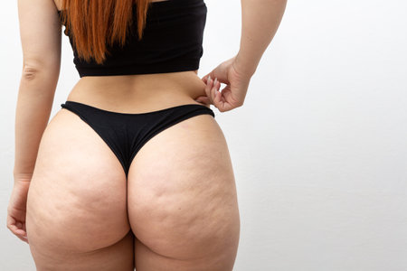 Back of an unrecognizable fleshy woman, while touching the folds of fat with cellulite on the buttocks and thighs. Beauty concept of curvy woman and adolescent complex for her physique.の写真素材