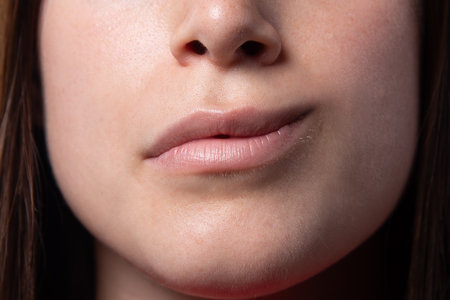 close-up of the mouth of a girl with hemiparesis, Bell's palsy. Forced smile across half face. Muscles paralyzed by inflammation of the facial nerveの写真素材