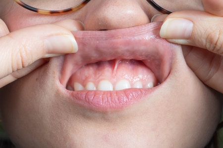 Close-up shot of a person's open mouth, displaying healthy teeth and gums, and the texture of the...