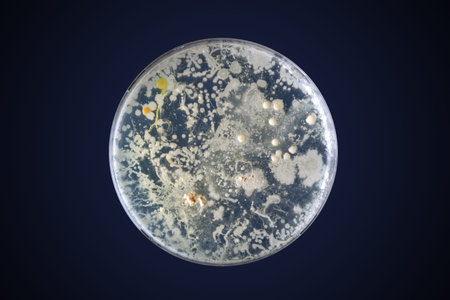 Bacteria growing in a petri dish