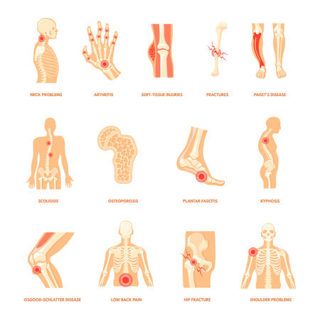 Body orthopedic problem. Human bone injury, anatomy health diseases plantar fasciitis arthritis joint fracture foot pain shoulder knee back ankle sport injuries cartoon neat vectorのイラスト素材