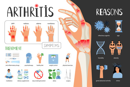 Rheumatoid arthritis vector medical poster. Symptoms treatment reasons of the disease. Medical infographic set with icons and other elementsのイラスト素材