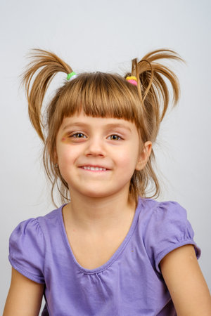 Portrait of smiling little caucasian girl with pigtails and bruise under the eye. Vertical orientationの写真素材