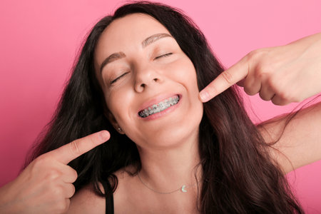 young beautiful brunette girl in braces. smiles beautifully. health concept. teeth.の写真素材