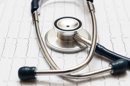 stethoscope on the cardiogramの写真素材