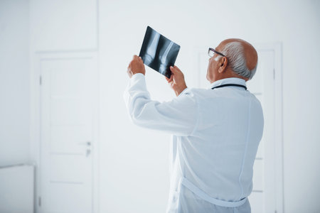 Senior man doctor in white uniform examines x-ray of human legs.