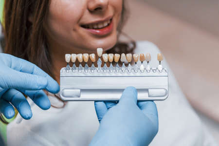 Dentist checks level of teeth whitening with color. Young adult woman have a visit in the clinic.の写真素材