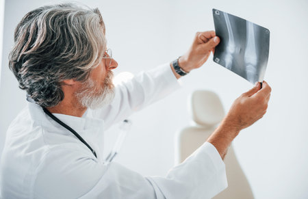 Looks at x-ray. Senior male doctor with grey hair and beard in white coat is indoors in clinicの写真素材