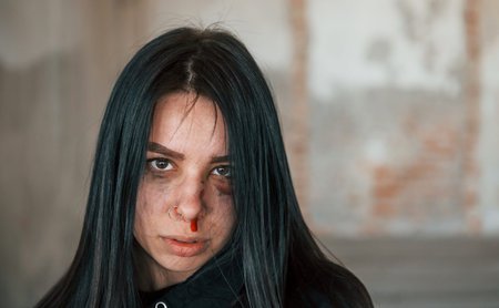 Portrait of beaten young woman with bruise under eye indoors in abandoned buildingの写真素材