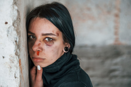 Portrait of beaten young woman with bruise under eye that standing and leaning on the wall indoors in abandoned buildingの写真素材