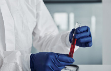 Male doctor scientist in lab coat, defensive eyewear and mask holds test tube with bloodの写真素材