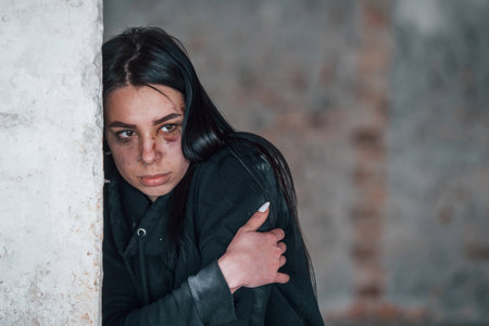 Portrait of beaten young woman with bruise under eye that standing and leaning on the wall indoors in abandoned buildingの写真素材