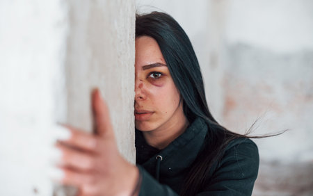 Portrait of beaten young woman with bruise under eye that standing and leaning on the wall indoors in abandoned buildingの写真素材