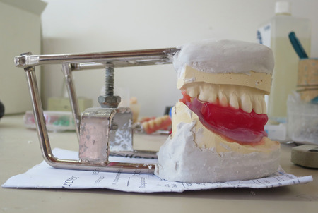 denture mold plaster imprintの写真素材
