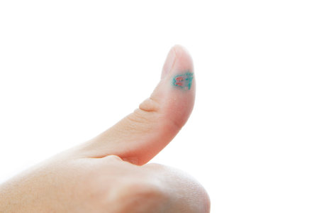 Thumb injury isolated on a white background.