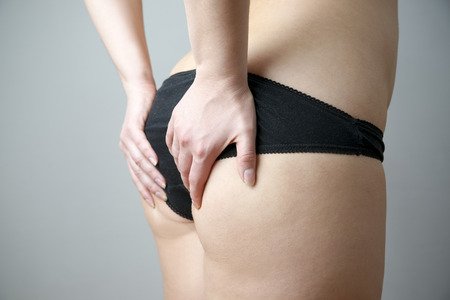 Buttocks massage against cellulite. Fatty female hips. Skin care, cellulite. Obesityの写真素材