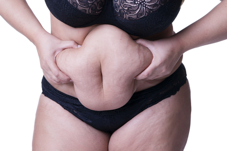 Fat female belly after pregnancy, stretch marks closeup, isolated on white backgroundの写真素材