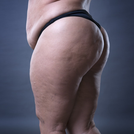 Fat female body with cellulite, fatty hips and buttocks on gray backgroundの写真素材