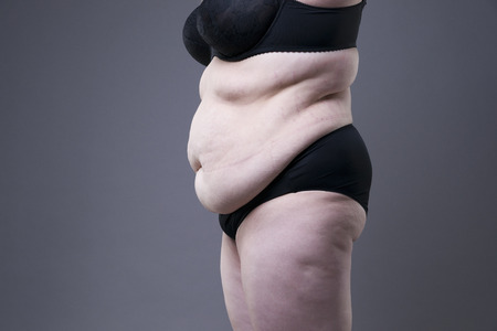 Plus size model in black lingerie, overweight female body, fat woman with stretch marks posing on gray backgroundの写真素材