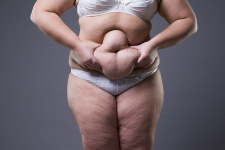 Overweight woman with fat legs, obesity female body on gray backgroundの写真素材