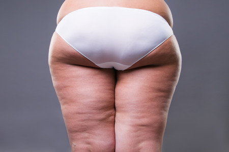 Fat female body with cellulite, overweight hips and buttocks on gray backgroundの写真素材