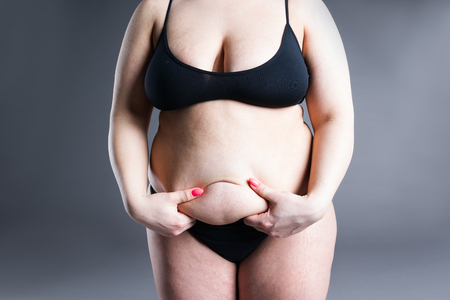 Overweight woman with fat belly, obesity female body on gray backgroundの写真素材