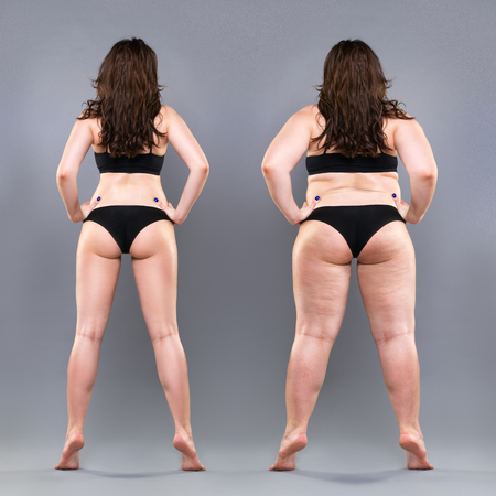 Woman's body before and after weight loss, gray background, full height plastic surgery conceptの写真素材