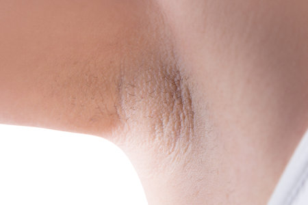Armpit skin after laser hair removal, close-up on white background