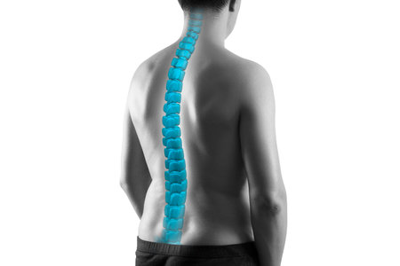 The human spine, sciatica and scoliosis isolated on white background, chiropractor treatment...